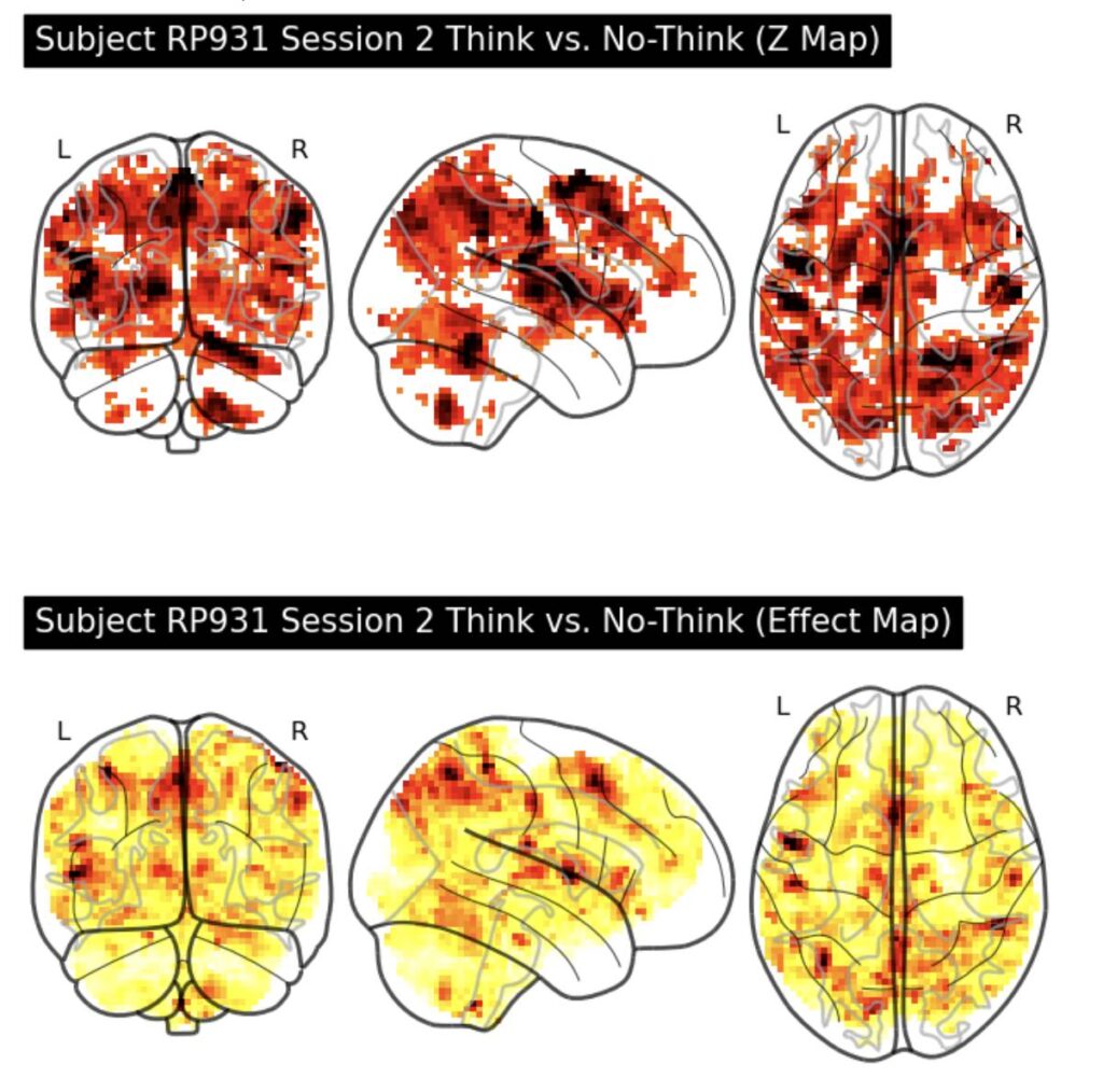 Glass brain plots